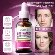 Load image into Gallery viewer, Sadoer Niacinamide Whiten Anti-Freckle 30ml
