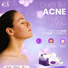 Load image into Gallery viewer, PEKAS ERASER 10G - New Packaging
